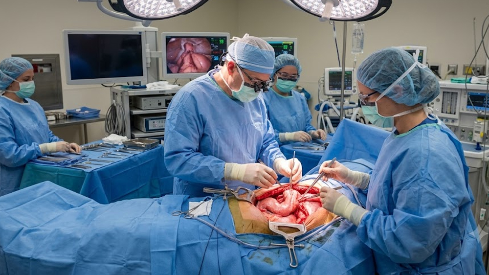 Esophagectomy