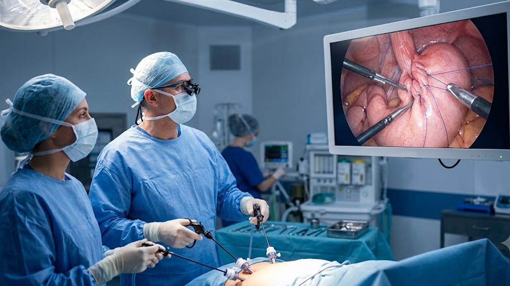 Laparoscopic Fundoplication
