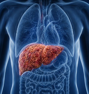 Liver disease